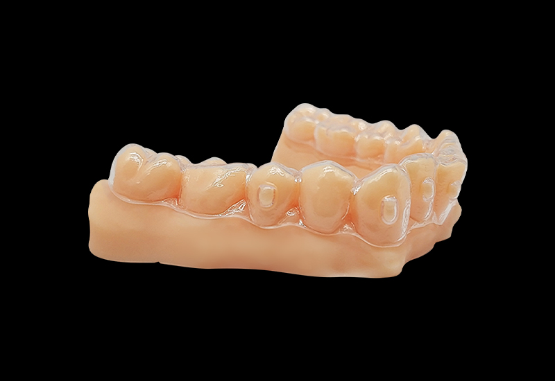 什么是3d打印正畸牙模？3d打印正畸牙模怎么做？